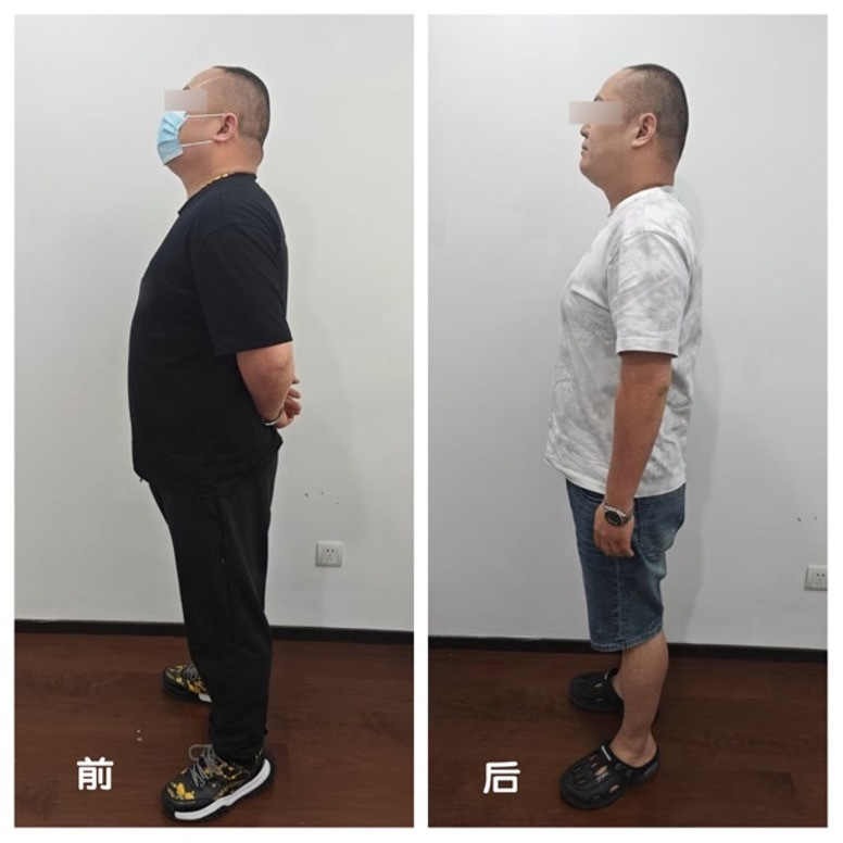 瘦身方式有, 经验分享和, 亚军选手安 瘦身方式有, 经验分享和, 亚军选手安